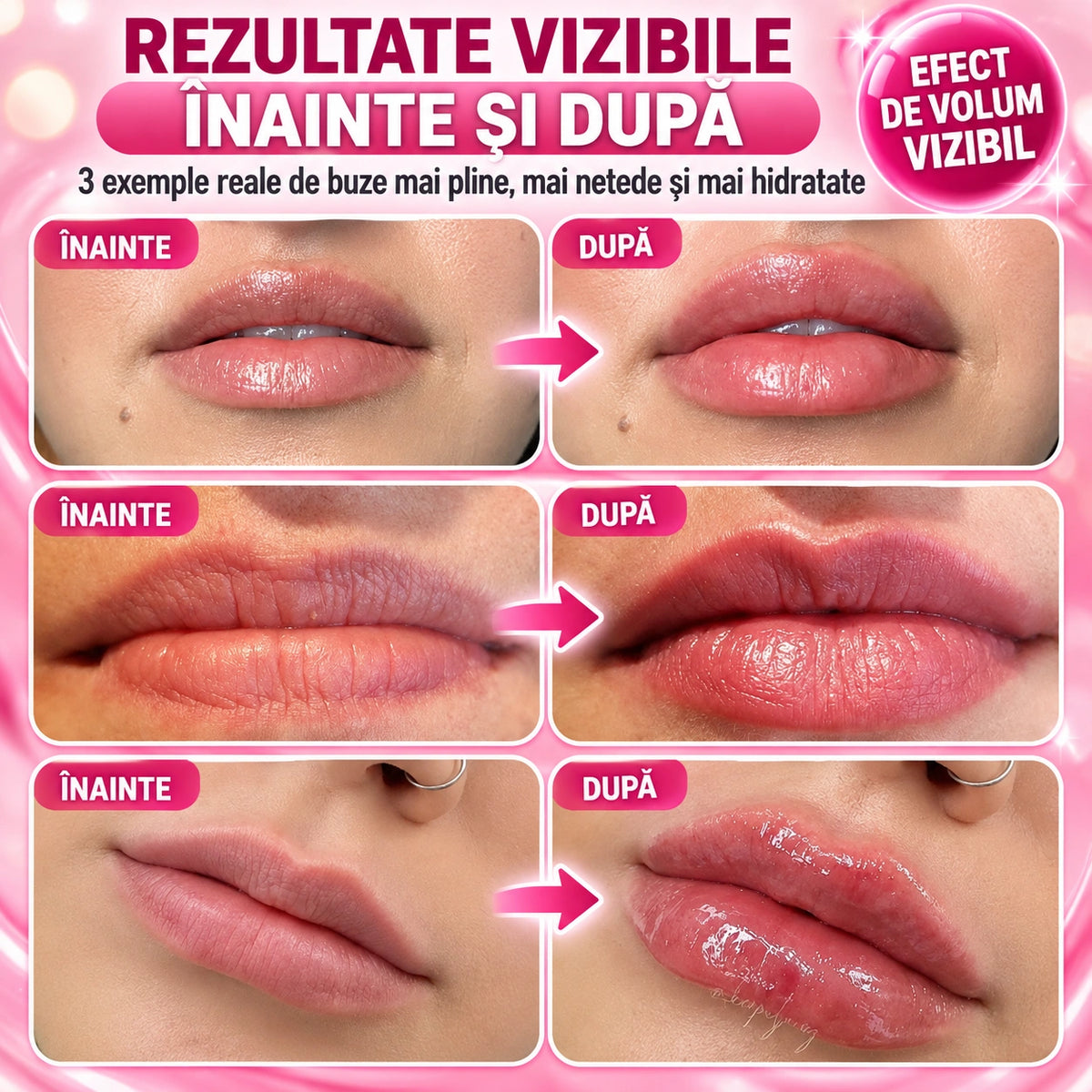 Ser pentru Buze cu Peptide