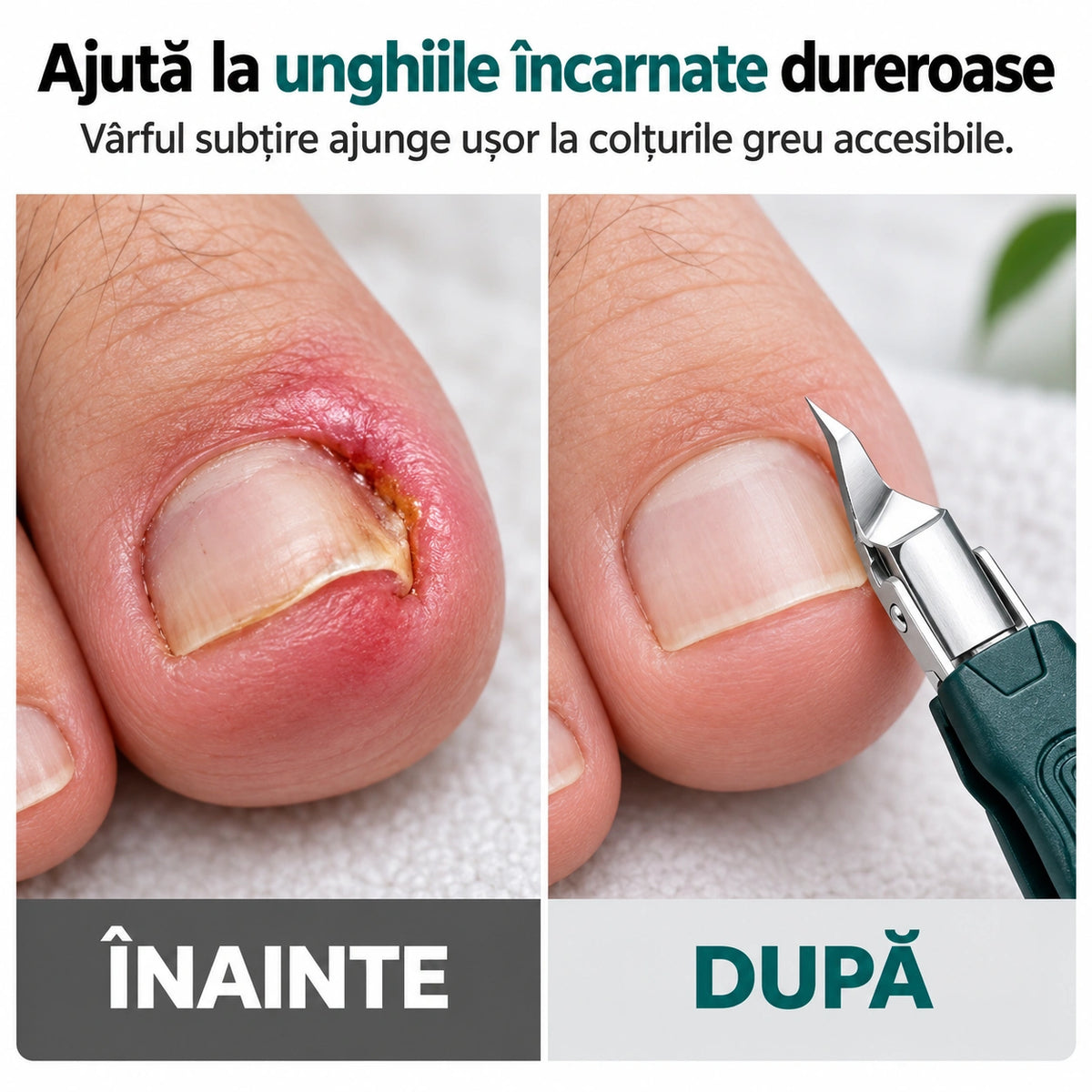 Kit Pentru Îngrijirea Unghiilor Încarnate